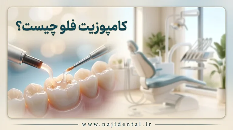 کامپوزیت فلو چیست