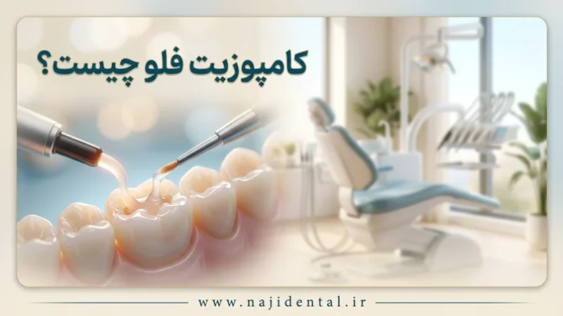 کامپوزیت فلو چیست